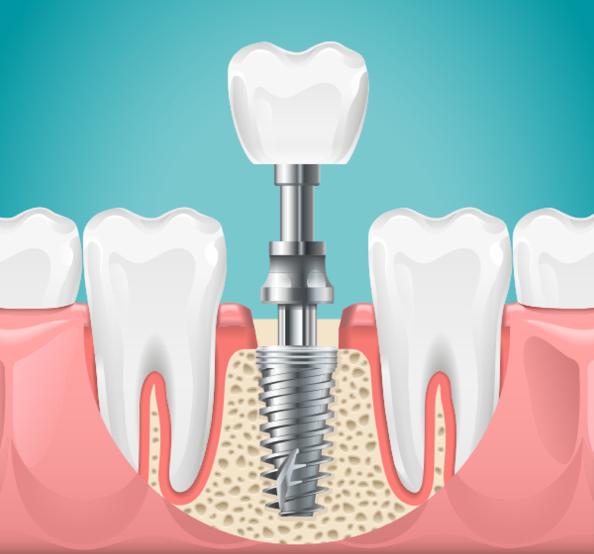 Зубные коронки: современные технологии и актуальные направления в стоматологии